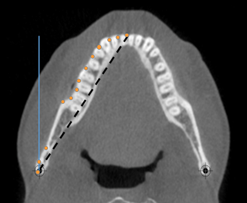 3D Cephalometry: Is It Right for Your Orthodontic Practice ...